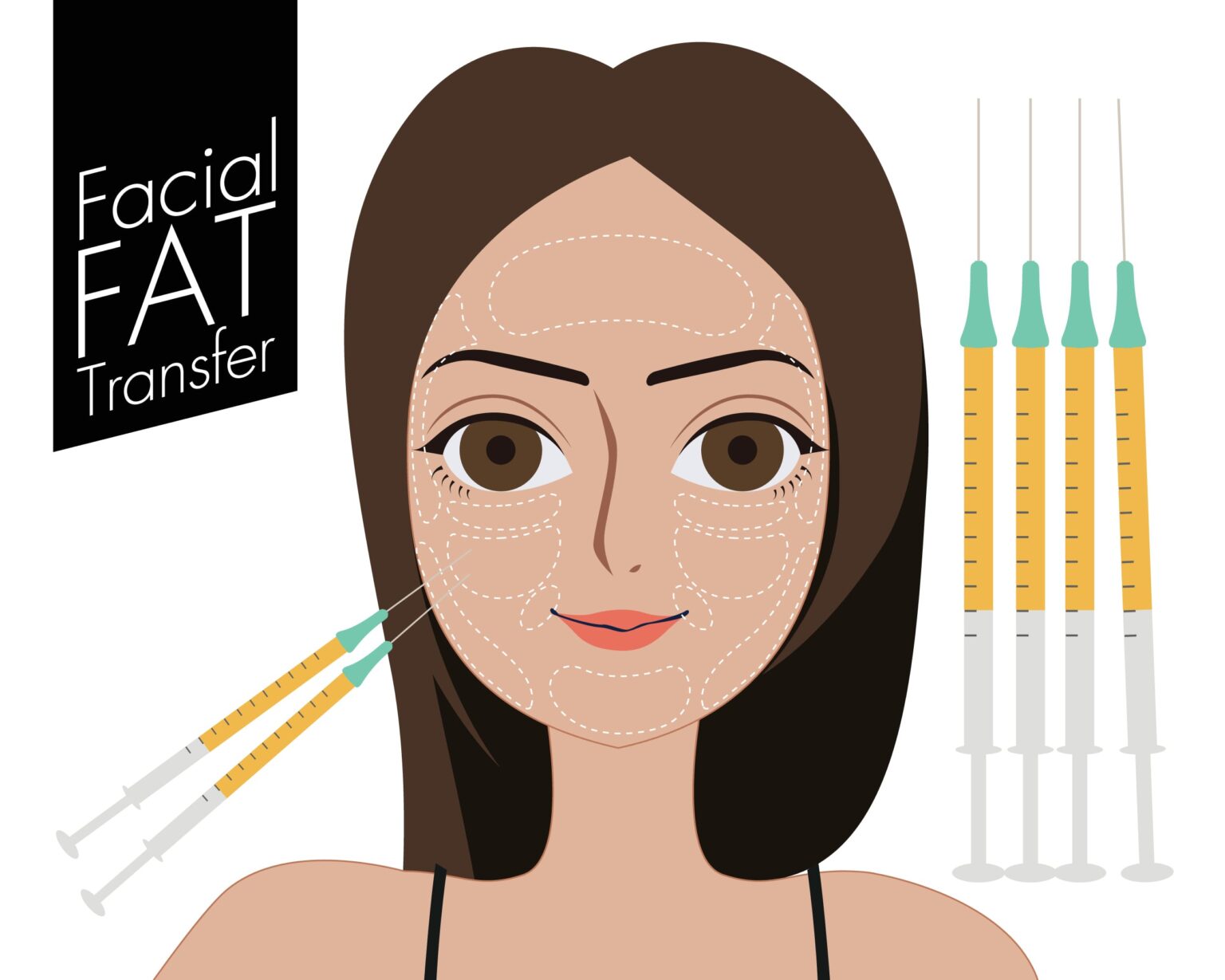 How Facial Fat Transfer Works Luxxery Boutique