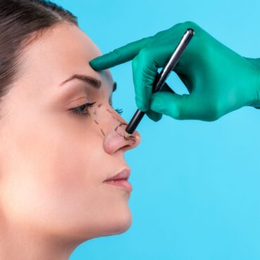 Is a Rhinoplasty Right for You?