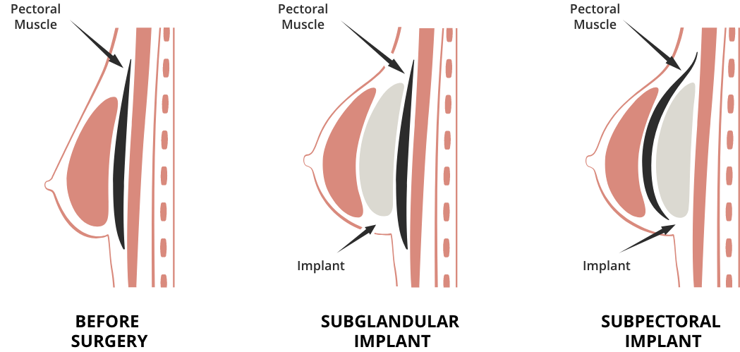 ba-diagram